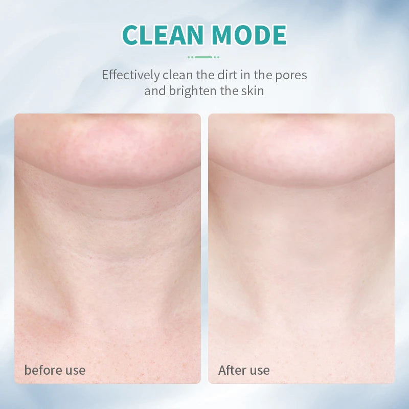 Face & Neck Beauty Device
