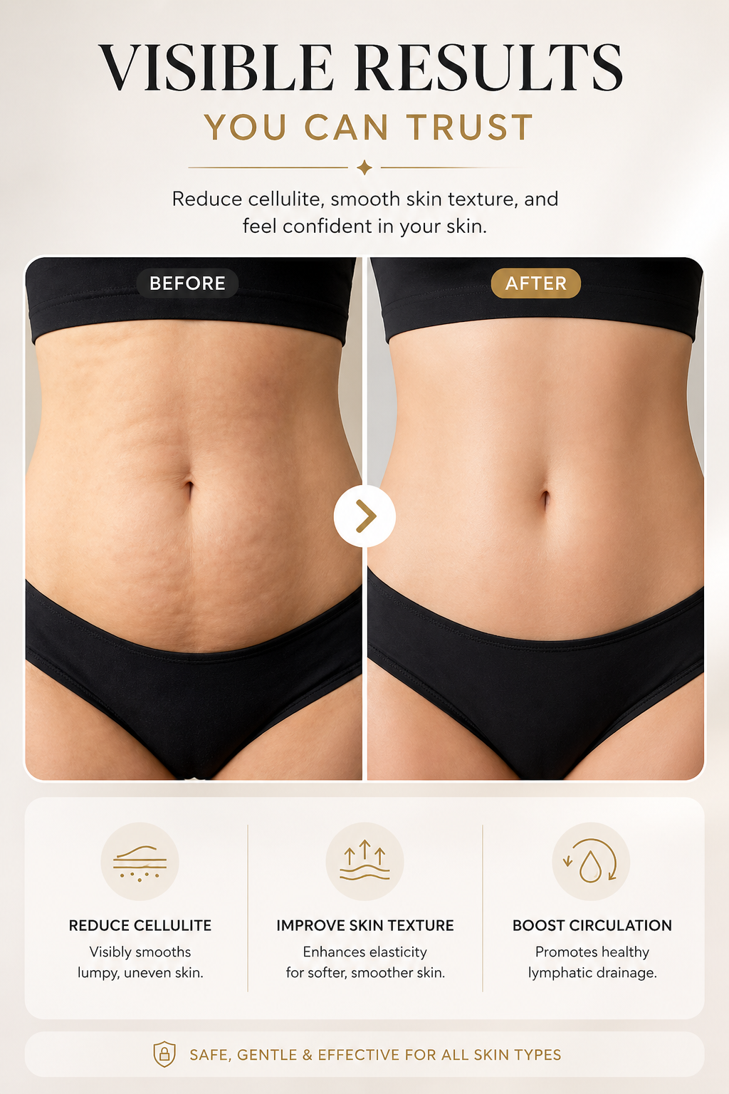 Anti-Cellulite Massager